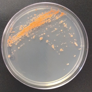 Picture of a circular covered container covered with an orange smear along one side, and orange round spots extending outward from the smear.
