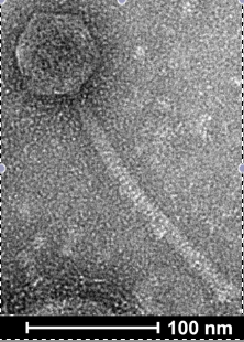 Electron micrograph picture of a phage with a scale marked at the bottom of 100 nanometers.