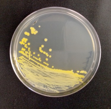 Picture of a circular covered container covered with an yellow smear along one side, and yellow round spots extending outward from the smear.